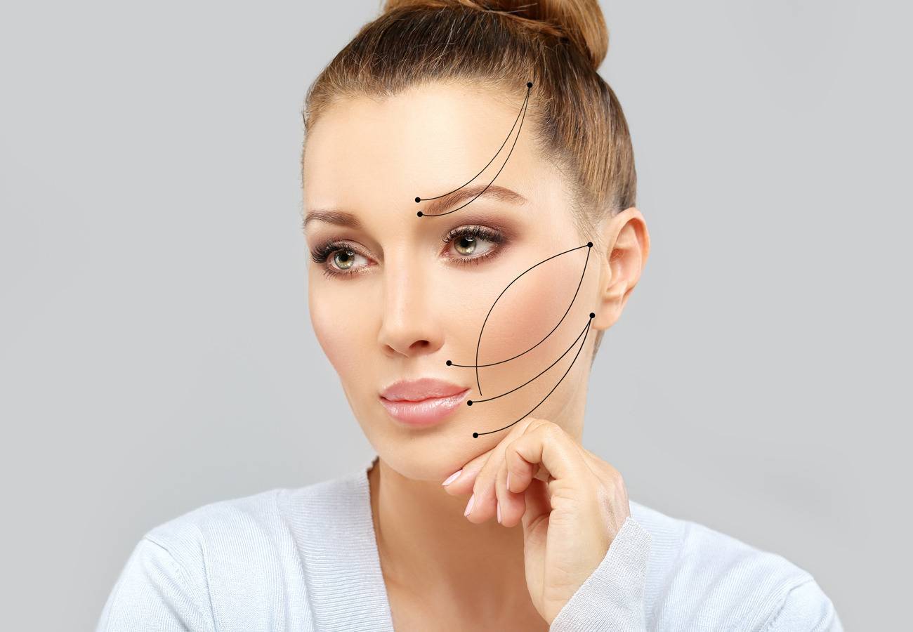 hilos faciales tensores Medellín