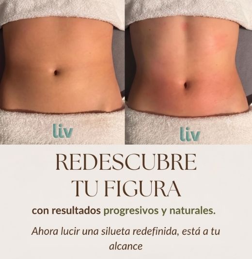 IMAGEN ANTES Y DESPUES